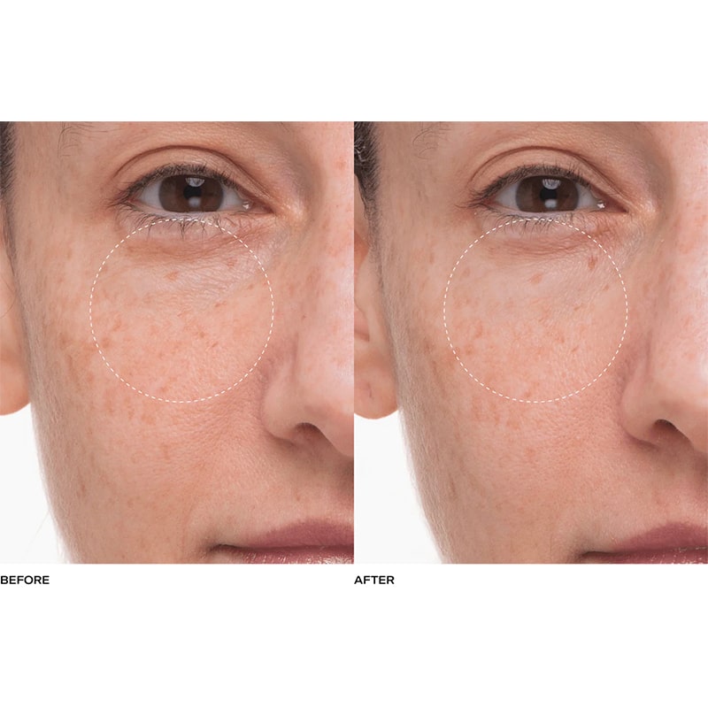 Plumtox Clarifying Enzyme Mask